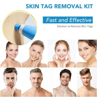 2 in 1 Auto Skin Tag Remover Kit Micro Skin Tag Removal Device Adult Mole Stain Wart Remover Face Care Beauty Tools Dropshipping